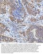 Anti-U1-C/SNRPC Antibody Picoband™