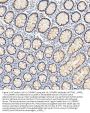 Anti-U1-C/SNRPC Antibody Picoband™