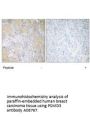 Anti-PSMD3 Antibody