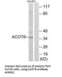 Anti-Acyl-coenzyme A thioesterase 8 ACOT8 Antibody