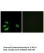 Anti-Acyl-coenzyme A thioesterase 8 ACOT8 Antibody