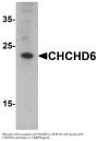 Anti-MICOS complex subunit MIC25 CHCHD6 Antibody