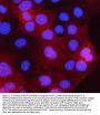 Anti-PCTP-L/STARD10 Antibody Picoband™