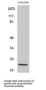 Anti-NDUFB10 Antibody