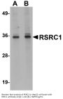 Anti-RSRC1 Antibody