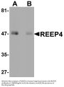 Anti-REEP4 Antibody