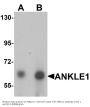 Anti-ANKLE1 Antibody