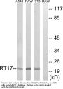 Anti-MRPS17 Antibody