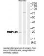 Anti-MRPL49 Antibody