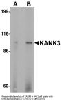Anti-KANK3 Antibody