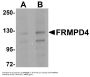 Anti-FRMPD4 TMEM94 Antibody