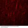 Anti-FRMPD4 TMEM94 Antibody