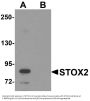 Anti-Storkhead-box protein 2 STOX2 Antibody