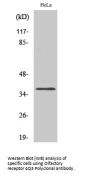 Anti-Olfactory receptor 4Q3 Antibody