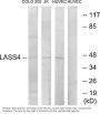 Anti-LASS4 Antibody