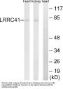 Anti-LRRC41 Antibody