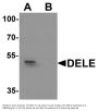 Anti-DELE DELE1 Antibody