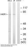 HKR1 Colorimetric Cell-Based ELISA