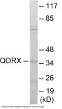 QORX Colorimetric Cell-Based ELISA