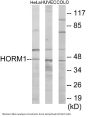 HORMAD1 Colorimetric Cell-Based ELISA