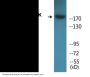 ALK (Phospho-Tyr1604) Colorimetric Cell-Based ELISA Kit