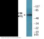 p70 S6 Kinase (Phospho-Ser411) Colorimetric Cell-Based ELISA Kit