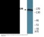 NMDAR2B (Phospho-Ser1303) Colorimetric Cell-Based ELISA Kit