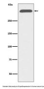 Anti-ApoB/Apolipoprotein B Rabbit Monoclonal Antibody