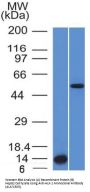 Anti-ALK (Anaplastic Lymphoma Kinase) / CD246 Monoclonal Antibody