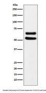 Anti-Ikaros Monoclonal Antibody