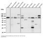 Anti-5 Lipoxygenase ALOX5 Monoclonal Antibody