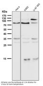 Anti-5 Lipoxygenase ALOX5 Monoclonal Antibody