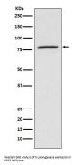 Anti-5 Lipoxygenase ALOX5 Monoclonal Antibody