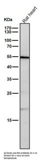 Anti-CD209 Rabbit Monoclonal Antibody