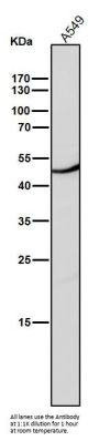 Anti-CD209 Rabbit Monoclonal Antibody