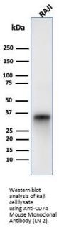 Anti-CD74 (B-Cell Marker) Monoclonal Antibody