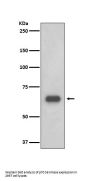 Anti-p70 S6 Kinase RPS6KB1 Rabbit Monoclonal Antibody