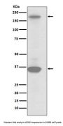 Anti-RON Rabbit Monoclonal Antibody