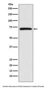 Anti-BIRC2 Monoclonal Antibody