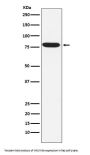 Anti-IKBKE Monoclonal Antibody