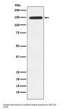 Anti-Xanthine Oxidase Rabbit Monoclonal Antibody