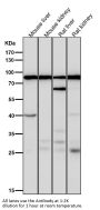 Anti-ACSS2/Acetyl Coa Synthetase Rabbit Monoclonal Antibody