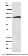 Anti-ACSS2/Acetyl Coa Synthetase Rabbit Monoclonal Antibody