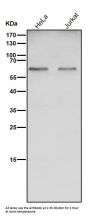 Anti-Catalase Rabbit Monoclonal Antibody