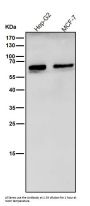 Anti-Catalase Rabbit Monoclonal Antibody