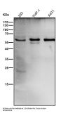 Anti-Catalase Rabbit Monoclonal Antibody