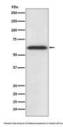 Anti-Catalase Rabbit Monoclonal Antibody