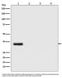 Anti-Renilla Luciferase Rabbit Monoclonal Antibody