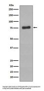Anti-Phospho-BTK (Y223) Rabbit Monoclonal Antibody