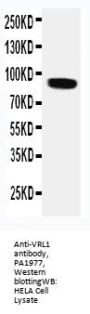 Anti-VRL1/TRPV2 Antibody